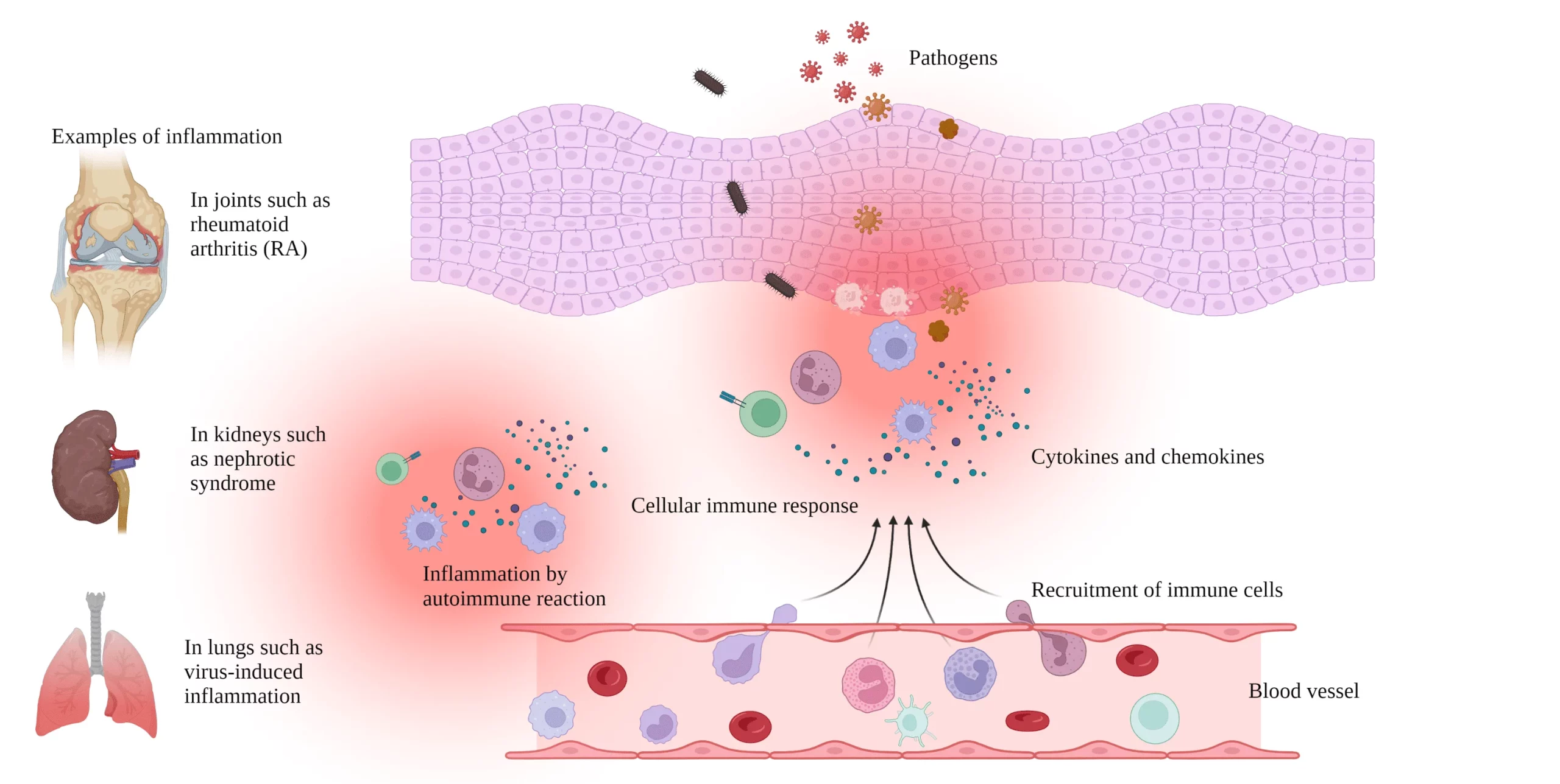 Resolving Inflammation SynAct Pharma